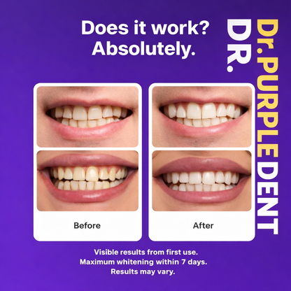 Dr. Purple Dent™ Teeth Whitening Strips